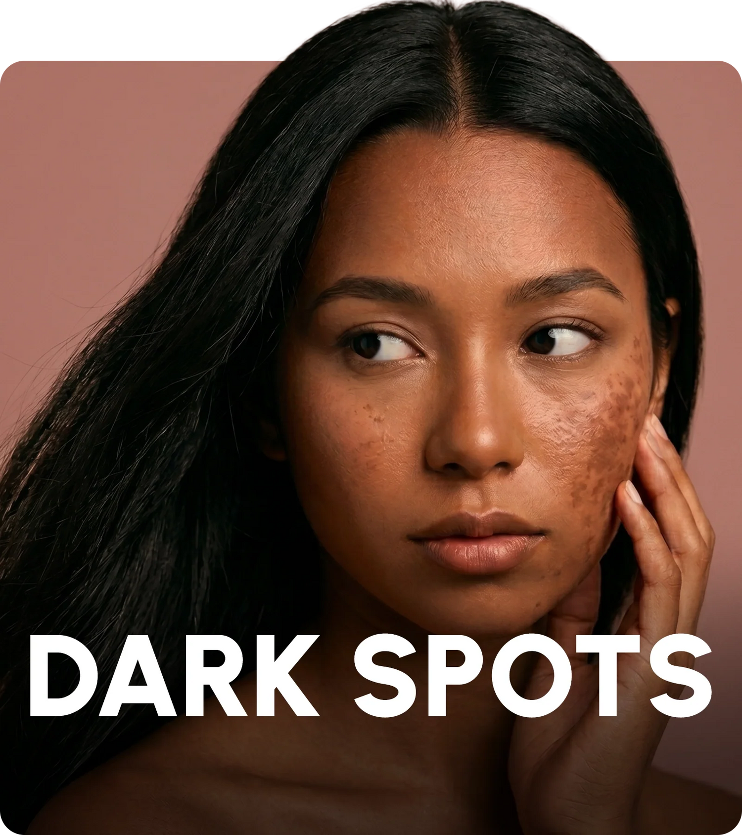 Dark Spots