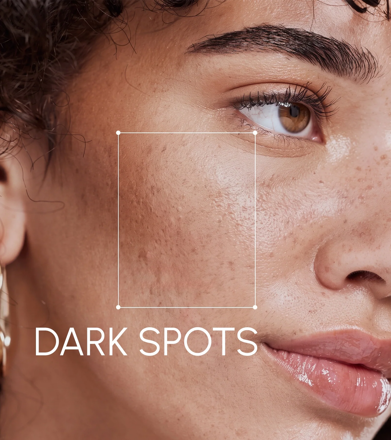 Dark Spots