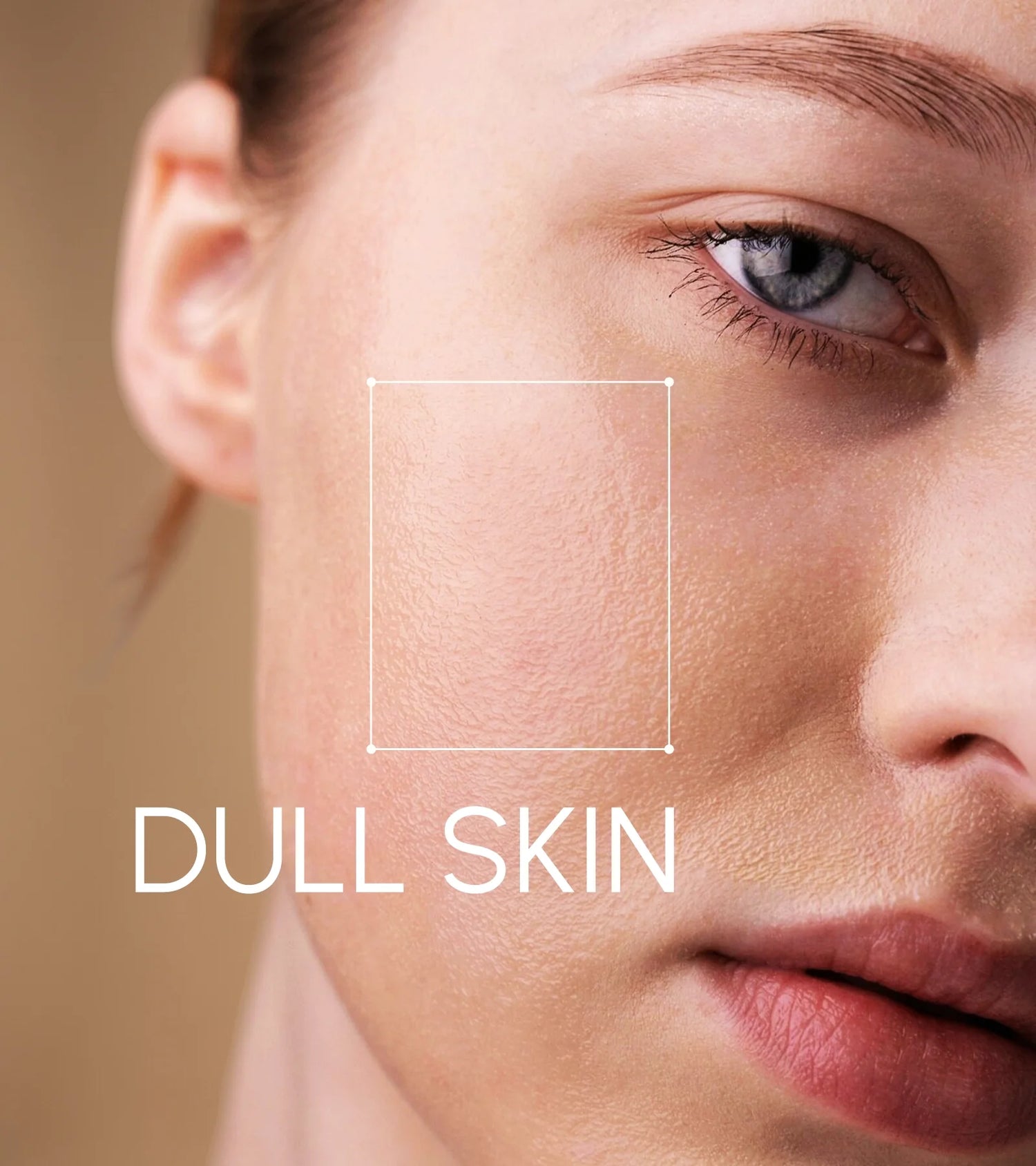 Dull Skin